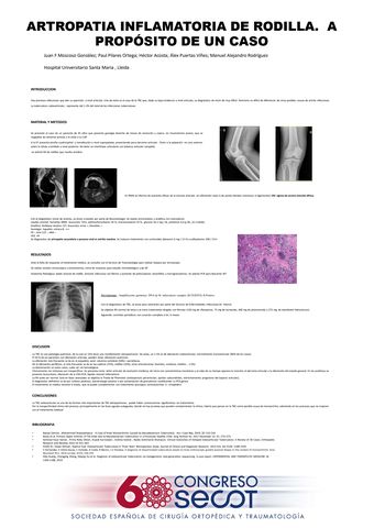 ANATOMIA Y FUNCIÓN DE LA RODILLA – Rafael Pérez Nuñez